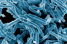 World TB Day